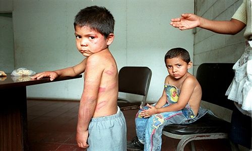 Tortura y secuelas en niños | Escritos